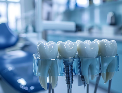 How Much Are Dental Implants: A Comprehensive UK Guide for 2024